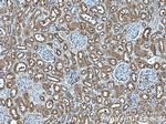 EIF2AK2/PKR Antibody in Immunohistochemistry (Paraffin) (IHC (P))