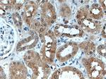 EIF2AK2/PKR Antibody in Immunohistochemistry (Paraffin) (IHC (P))