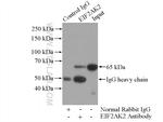 EIF2AK2/PKR Antibody in Immunoprecipitation (IP)