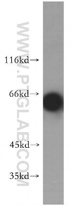 EIF2AK2/PKR Antibody in Western Blot (WB)