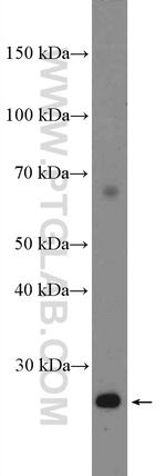PD-L2/CD273 Antibody in Western Blot (WB)