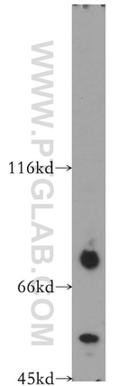 TRMT5 Antibody in Western Blot (WB)