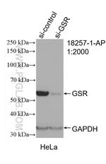 GSR Antibody in Western Blot (WB)