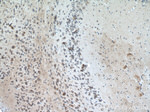 ATG13 Antibody in Immunohistochemistry (Paraffin) (IHC (P))