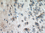 ATG13 Antibody in Immunohistochemistry (Paraffin) (IHC (P))