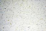 ATG13 Antibody in Immunohistochemistry (Paraffin) (IHC (P))