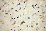 ATG13 Antibody in Immunohistochemistry (Paraffin) (IHC (P))