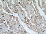 ATG13 Antibody in Immunohistochemistry (Paraffin) (IHC (P))