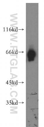 ATG13 Antibody in Western Blot (WB)