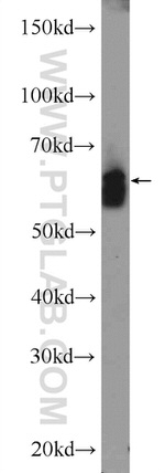 ATG13 Antibody in Western Blot (WB)