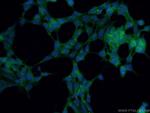 PDK1 Antibody in Immunocytochemistry (ICC/IF)