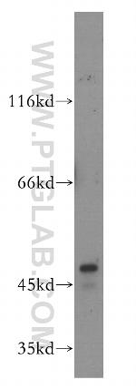 PDK1 Antibody in Western Blot (WB)