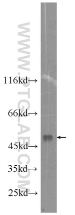 PDK1 Antibody in Western Blot (WB)