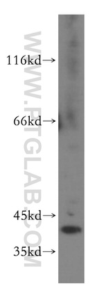 PHLDA1 Antibody in Western Blot (WB)