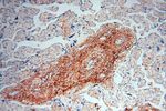 P2RY1 Antibody in Immunohistochemistry (Paraffin) (IHC (P))