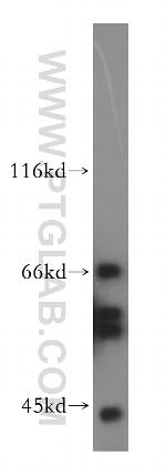 P2RY1 Antibody in Western Blot (WB)