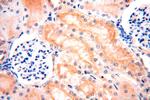 ATP6V0D1 Antibody in Immunohistochemistry (Paraffin) (IHC (P))