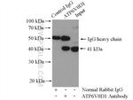 ATP6V0D1 Antibody in Immunoprecipitation (IP)