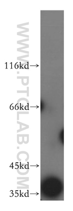 ATP6V0D1 Antibody in Western Blot (WB)