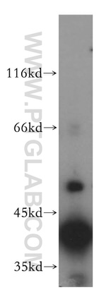 ATP6V0D1 Antibody in Western Blot (WB)