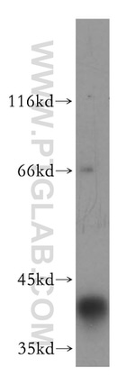 ATP6V0D1 Antibody in Western Blot (WB)