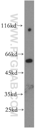 Fukutin Antibody in Western Blot (WB)