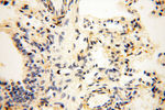 STRAP Antibody in Immunohistochemistry (Paraffin) (IHC (P))