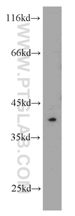 STRAP Antibody in Western Blot (WB)