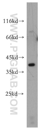 STRAP Antibody in Western Blot (WB)