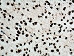 TDP-43 Antibody in Immunohistochemistry (Paraffin) (IHC (P))