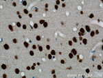 TDP-43 Antibody in Immunohistochemistry (Paraffin) (IHC (P))