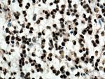 TDP-43 Antibody in Immunohistochemistry (Paraffin) (IHC (P))