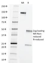 TAG-72/CA72.4 (Tumor-Associated Glycoprotein) Antibody in SDS-PAGE (SDS-PAGE)