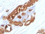 TAG-72/CA72.4 (Tumor-Associated Glycoprotein) Antibody in Immunohistochemistry (Paraffin) (IHC (P))