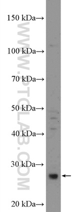 KCNE4 Antibody in Western Blot (WB)