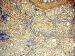 MEF2C Antibody in Immunohistochemistry (Paraffin) (IHC (P))