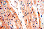 MEF2C Antibody in Immunohistochemistry (Paraffin) (IHC (P))