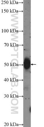 MEF2C Antibody in Western Blot (WB)