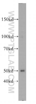 MEF2C Antibody in Western Blot (WB)