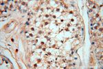 MEF2C Antibody in Immunohistochemistry (Paraffin) (IHC (P))