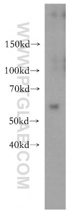 MEF2C Antibody in Western Blot (WB)