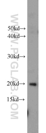 HRAS Antibody in Western Blot (WB)