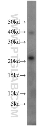 HRAS Antibody in Western Blot (WB)