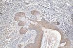 NRAS Antibody in Immunohistochemistry (Paraffin) (IHC (P))