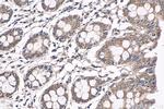 NRAS Antibody in Immunohistochemistry (Paraffin) (IHC (P))