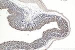 NRAS Antibody in Immunohistochemistry (Paraffin) (IHC (P))