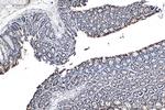 NRAS Antibody in Immunohistochemistry (Paraffin) (IHC (P))