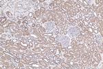 NRAS Antibody in Immunohistochemistry (Paraffin) (IHC (P))