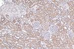 NRAS Antibody in Immunohistochemistry (Paraffin) (IHC (P))