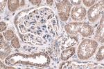 NRAS Antibody in Immunohistochemistry (Paraffin) (IHC (P))